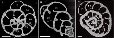 Chemical Heterogeneity of Mg, Mn, Na, S, and Sr in Benthic Foraminiferal Calcite